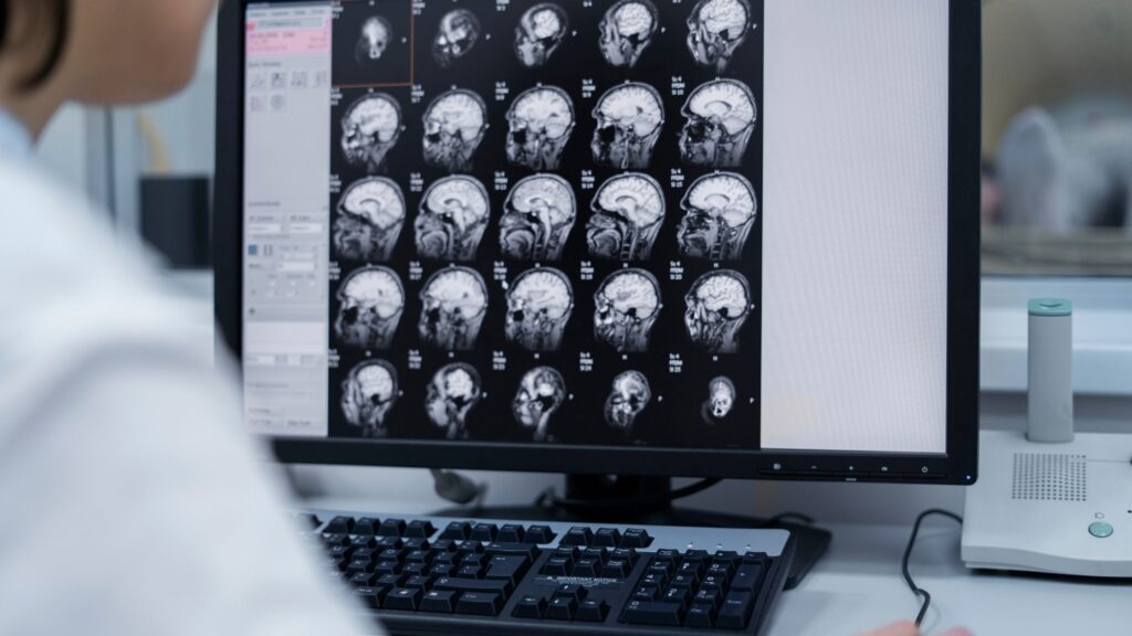 Quando fare una visita neurologica? I segnali da non ignorare