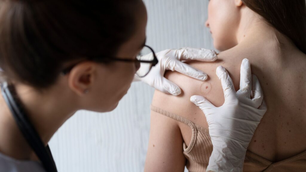 Perch&eacute; le cisti ritornano? Cause, prevenzione e soluzioni definitive